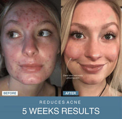 MzK™ | 7-in-1 LED Anti-Aging/Wrinkle Apparatus