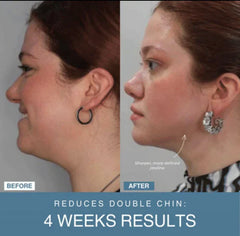 MzK™ | 7-in-1 LED Anti-Aging/Wrinkle Apparatus